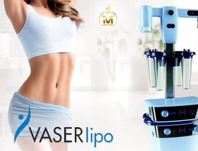 HÚT MỠ CỘNG NGHỆ VASER LIPO