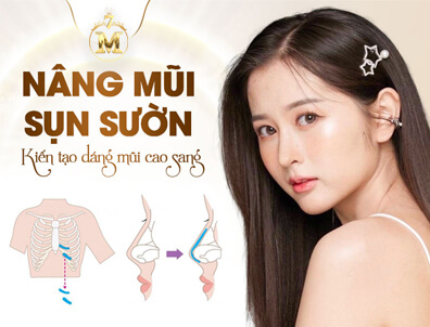 NÂNG MŨI SỤN SƯỜN